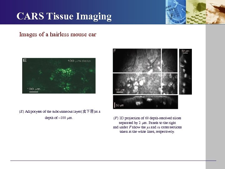  CARS Tissue Imaging Images of a hairless mouse ear (E) Adipocytes of the