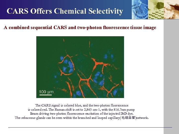 CARS Offers Chemical Selectivity A combined sequential CARS and two-photon fluorescence tissue image The