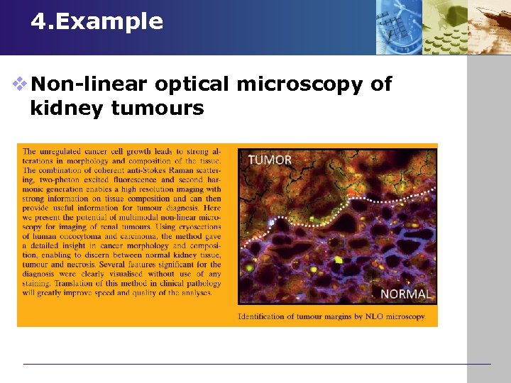 4. Example v Non-linear optical microscopy of kidney tumours 