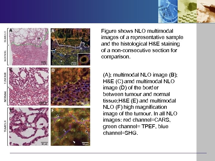 Figure shows NLO multimodal images of a representative sample and the histological H&E staining