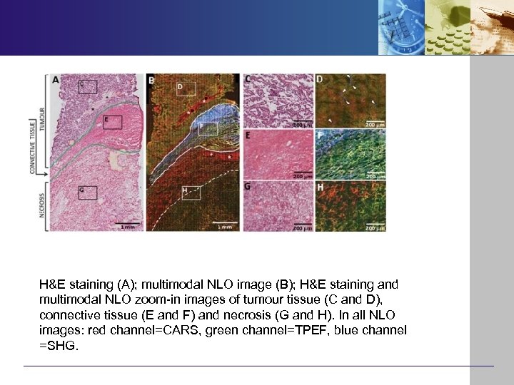 H&E staining (A); multimodal NLO image (B); H&E staining and multimodal NLO zoom-in images