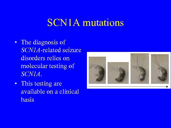 SCN 1 A mutations • The diagnosis of SCN 1 A-related seizure disorders relies