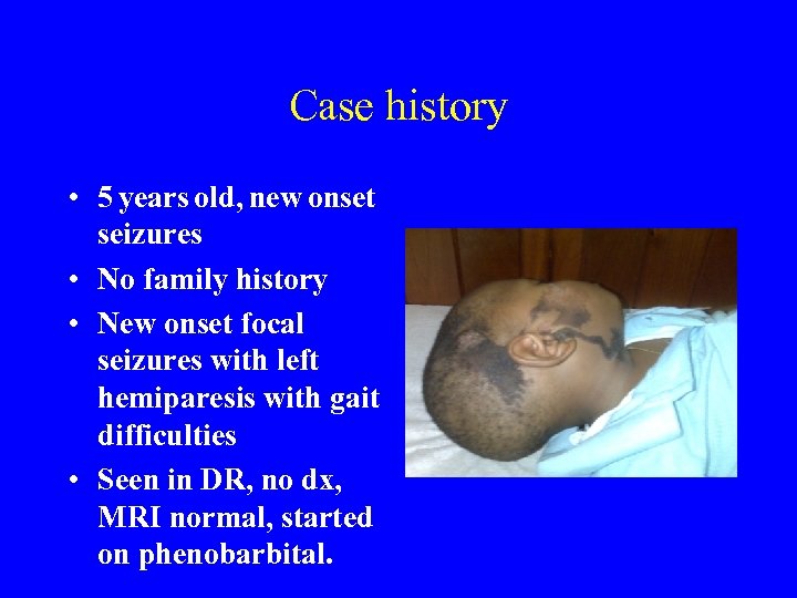 Case history • 5 years old, new onset seizures • No family history •