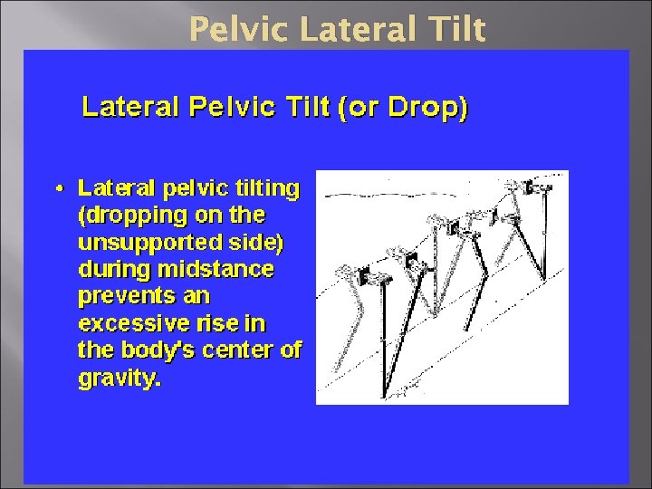 Pelvic Lateral Tilt 