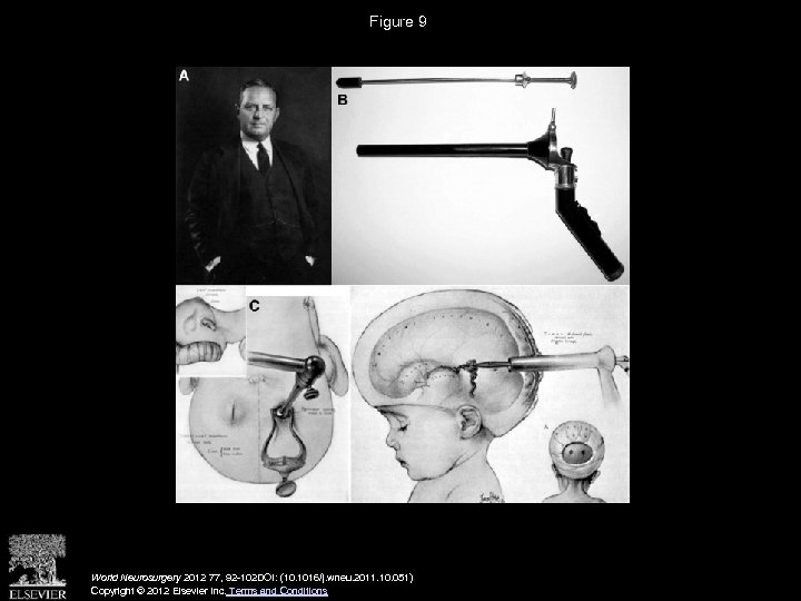 Figure 9 World Neurosurgery 2012 77, 92 -102 DOI: (10. 1016/j. wneu. 2011. 10.