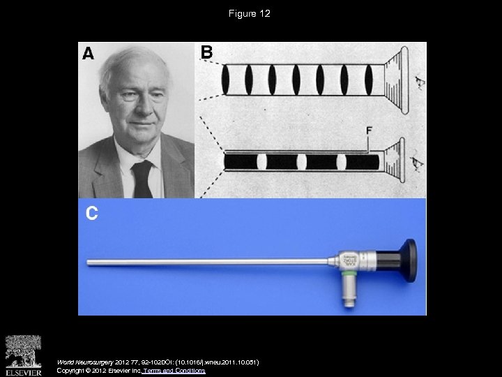 Figure 12 World Neurosurgery 2012 77, 92 -102 DOI: (10. 1016/j. wneu. 2011. 10.