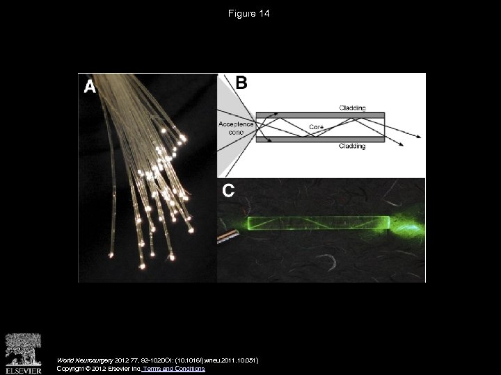 Figure 14 World Neurosurgery 2012 77, 92 -102 DOI: (10. 1016/j. wneu. 2011. 10.
