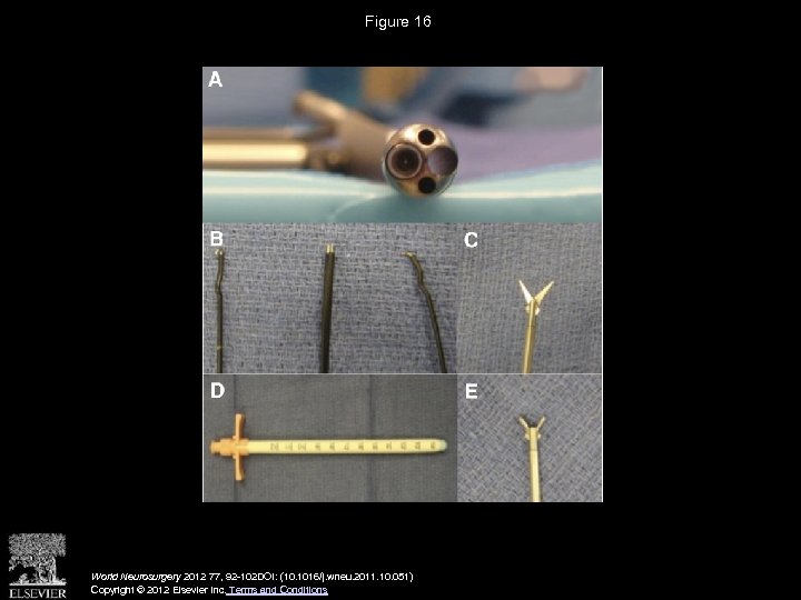 Figure 16 World Neurosurgery 2012 77, 92 -102 DOI: (10. 1016/j. wneu. 2011. 10.