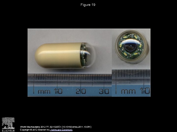 Figure 19 World Neurosurgery 2012 77, 92 -102 DOI: (10. 1016/j. wneu. 2011. 10.
