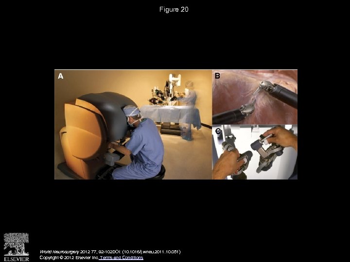 Figure 20 World Neurosurgery 2012 77, 92 -102 DOI: (10. 1016/j. wneu. 2011. 10.