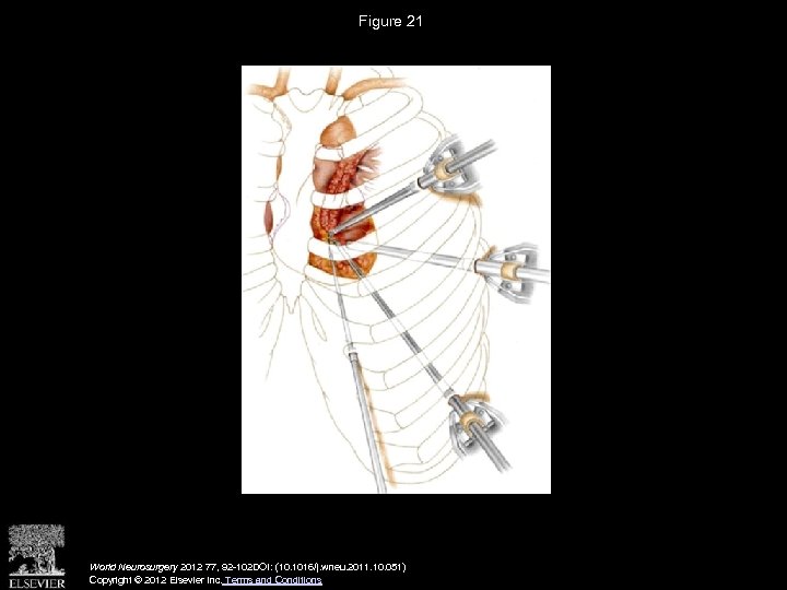 Figure 21 World Neurosurgery 2012 77, 92 -102 DOI: (10. 1016/j. wneu. 2011. 10.