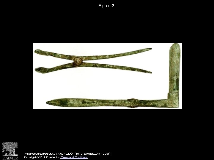 Figure 2 World Neurosurgery 2012 77, 92 -102 DOI: (10. 1016/j. wneu. 2011. 10.