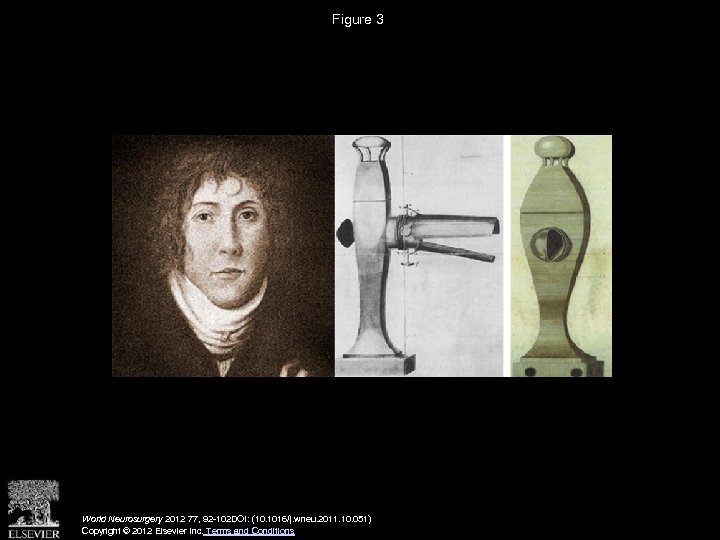 Figure 3 World Neurosurgery 2012 77, 92 -102 DOI: (10. 1016/j. wneu. 2011. 10.