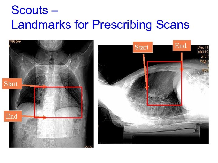 Scouts – Landmarks for Prescribing Scans Start End 