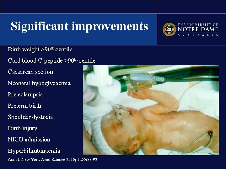 Significant improvements Birth weight >90 th centile Cord blood C-peptide >90 th centile Caesarean