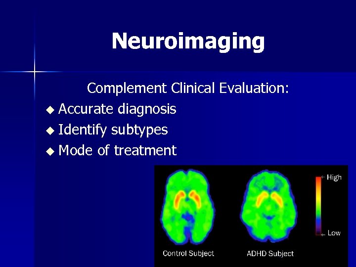 Neuroimaging Complement Clinical Evaluation: u Accurate diagnosis u Identify subtypes u Mode of treatment