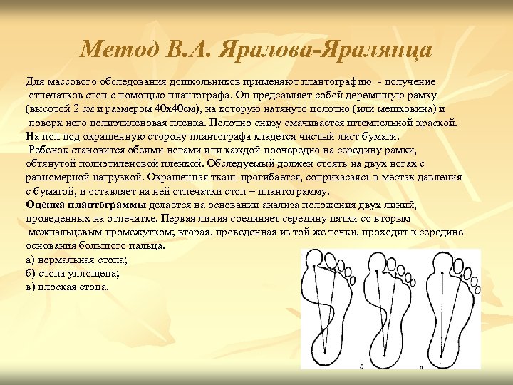 Метод В. А. Яралова-Яралянца Для массового обследования дошкольников применяют плантографию - получение отпечатков стоп