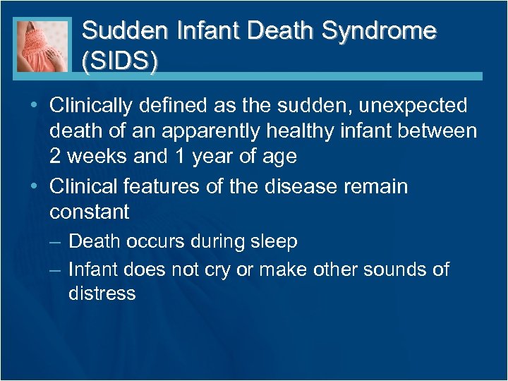 Sudden Infant Death Syndrome (SIDS) • Clinically defined as the sudden, unexpected death of