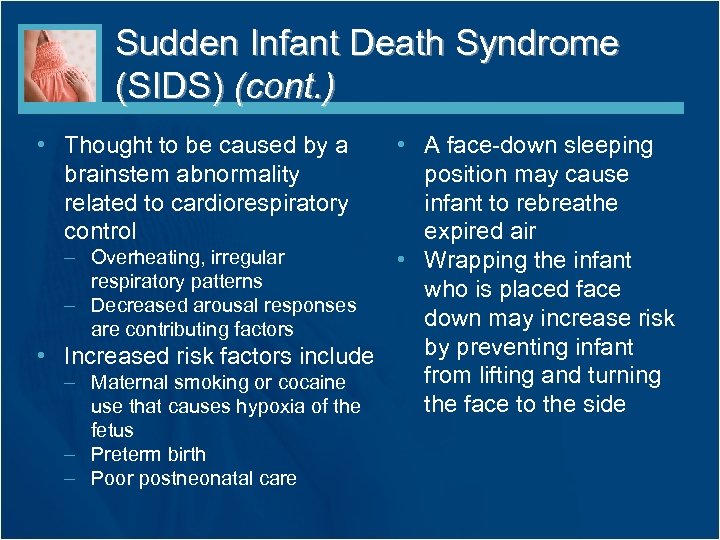 Sudden Infant Death Syndrome (SIDS) (cont. ) • Thought to be caused by a