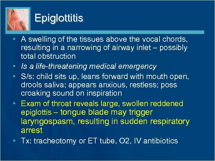Epiglottitis • A swelling of the tissues above the vocal chords, resulting in a