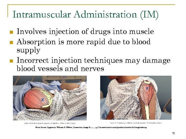 Intramuscular Administration (IM) n n n Involves injection of drugs into muscle Absorption is