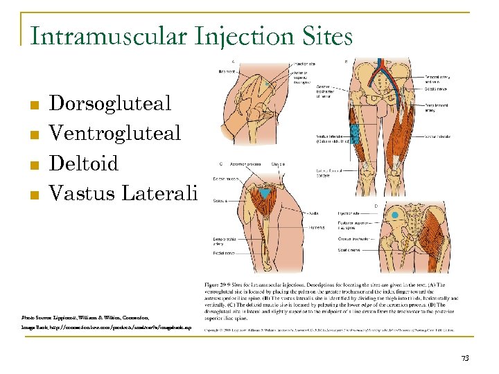 Intramuscular Injection Sites n n Dorsogluteal Ventrogluteal Deltoid Vastus Lateralis Photo Source: Lippincott, Williams