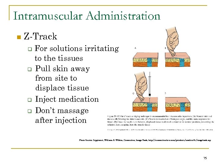 Intramuscular Administration n Z-Track q q For solutions irritating to the tissues Pull skin