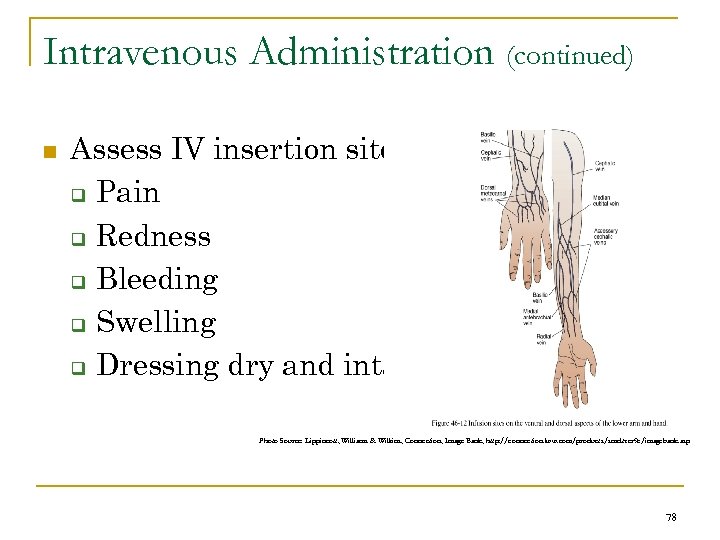 Intravenous Administration (continued) n Assess IV insertion site: q Pain q Redness q Bleeding