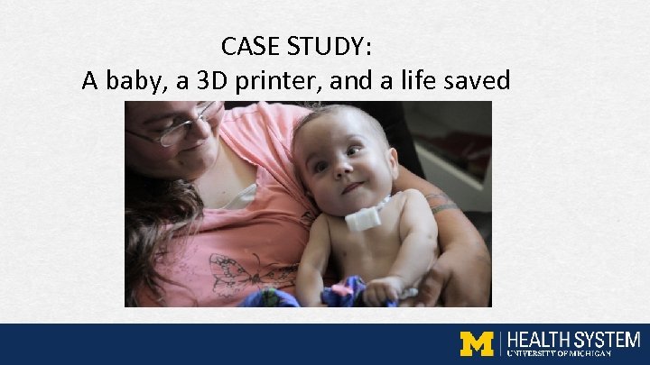 CASE STUDY: A baby, a 3 D printer, and a life saved 