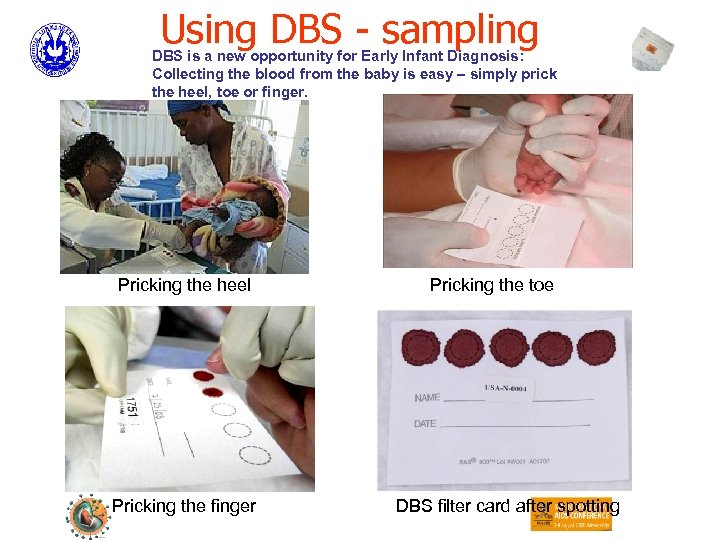 Using DBS - sampling DBS is a new opportunity for Early Infant Diagnosis: Collecting