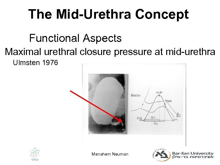 The Mid-Urethra Concept Functional Aspects Maximal urethral closure pressure at mid-urethra Ulmsten 1976 Menahem