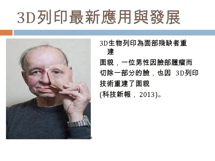 3 D列印最新應用與發展 3 D生物列印為面部殘缺者重 建 面貌，一位男性因臉部腫瘤而 切除一部分的臉，也因 3 D列印 技術重建了面貌 (科技新報， 2013)。 