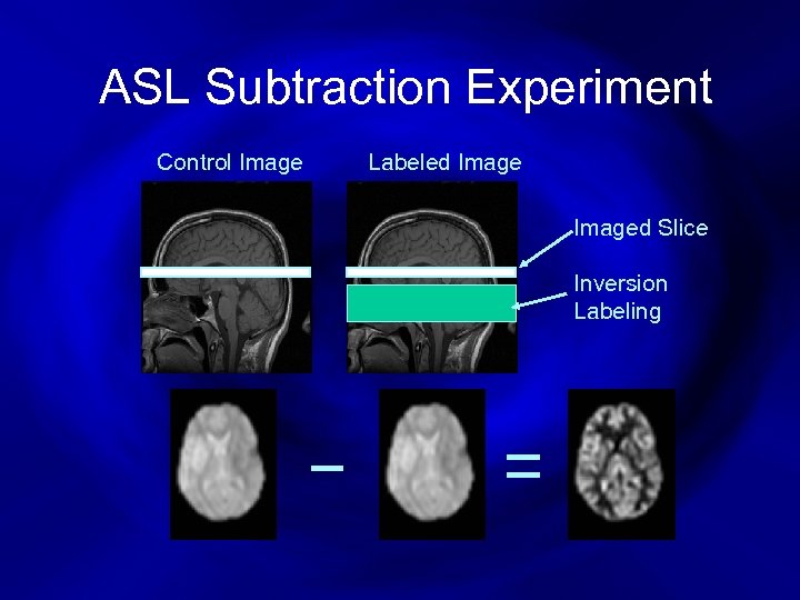 ASL Subtraction Experiment Control Image Labeled Imaged Slice Inversion Labeling 