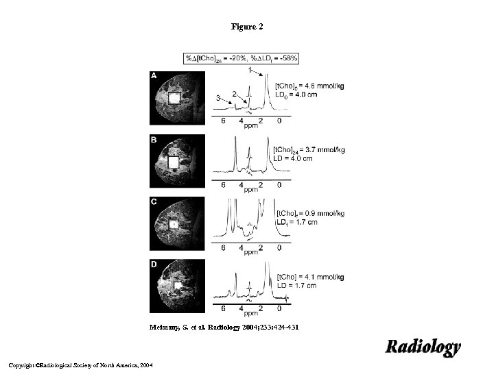 Figure 2 Meisamy, S. et al. Radiology 2004; 233: 424 -431 Copyright ©Radiological Society