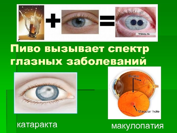 Пиво вызывает спектр глазных заболеваний катаракта макулопатия 