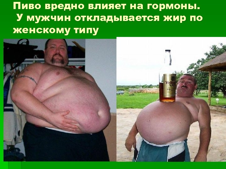 Пиво вредно влияет на гормоны. У мужчин откладывается жир по женскому типу 