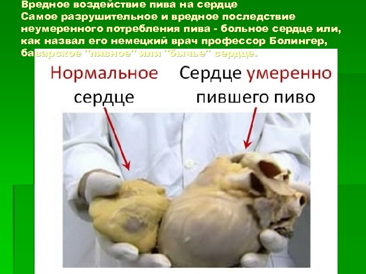 Вредное воздействие пива на сердце Самое разрушительное и вредное последствие неумеренного потребления пива -