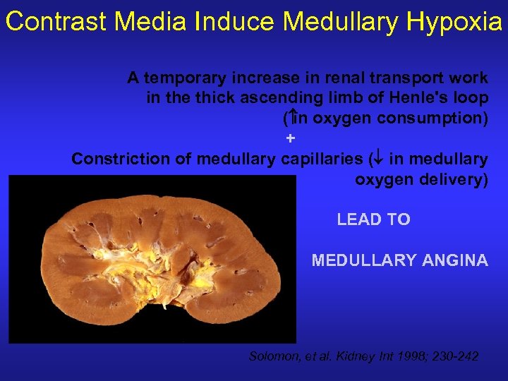 Contrast Media Induce Medullary Hypoxia A temporary increase in renal transport work in the