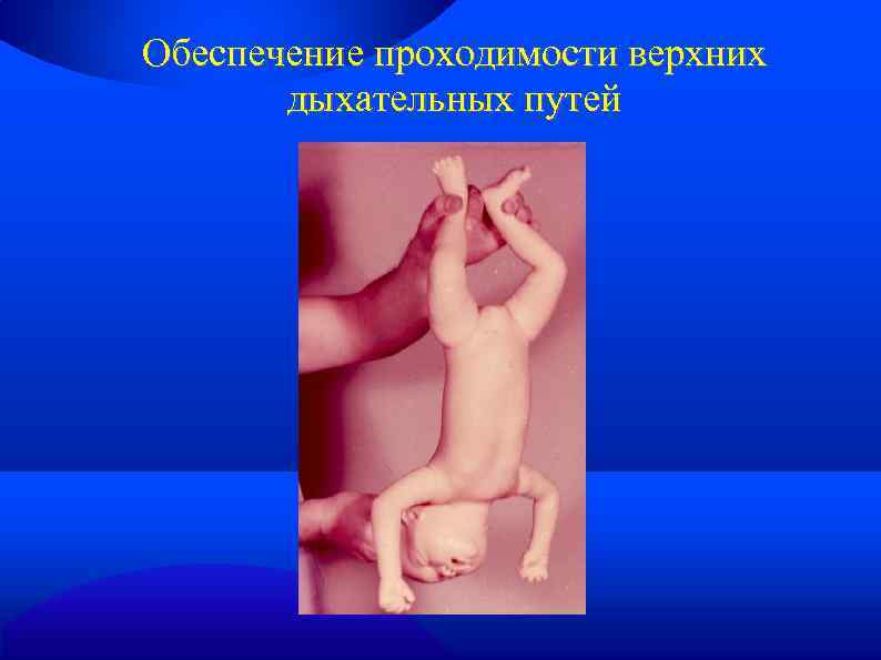 Обеспечение проходимости верхних дыхательных путей 