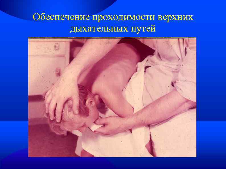 Обеспечение проходимости верхних дыхательных путей 