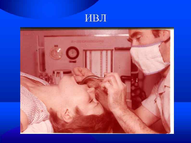 ИВЛ 