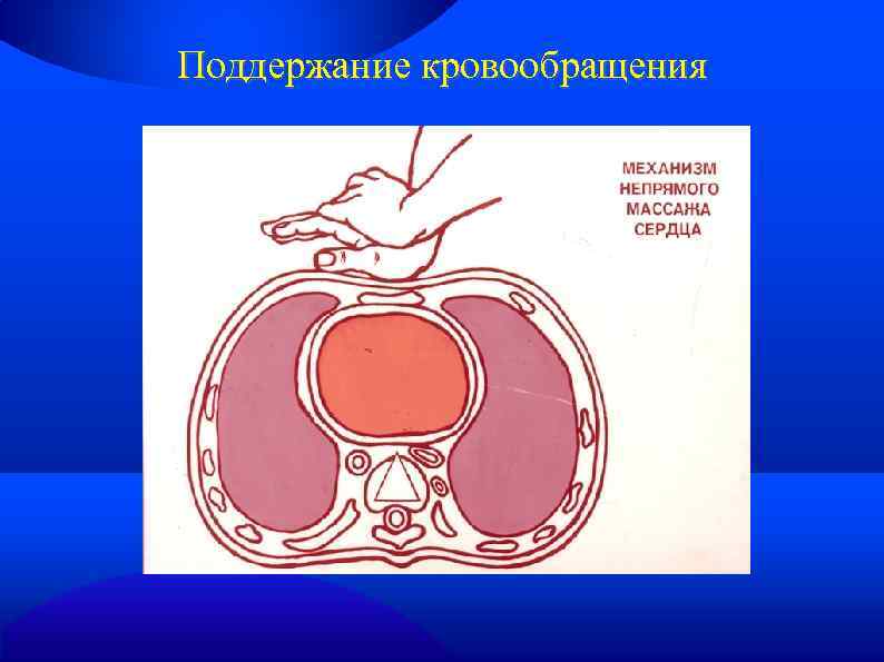 Поддержание кровообращения 