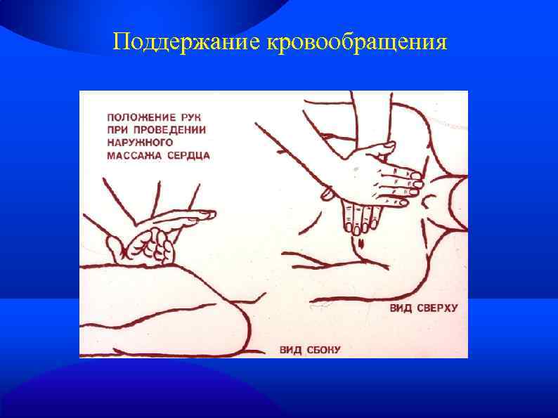 Поддержание кровообращения 