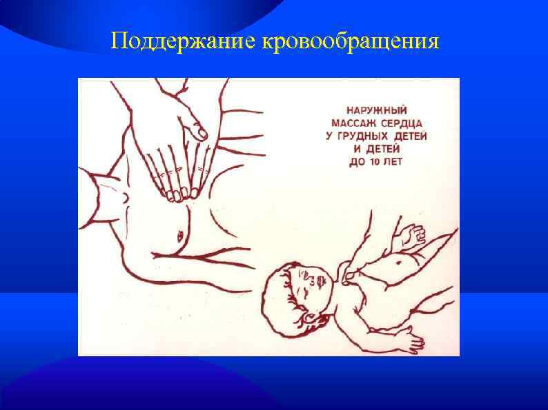 Поддержание кровообращения 