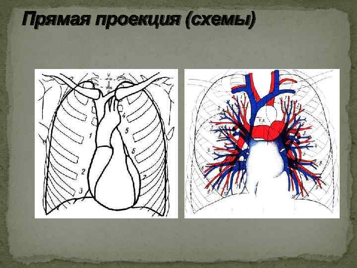 Прямая проекция (схемы) 