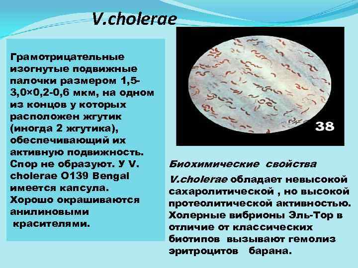 V. cholerae Грамотрицательные изогнутые подвижные палочки размером 1, 5 3, 0× 0, 2 0,