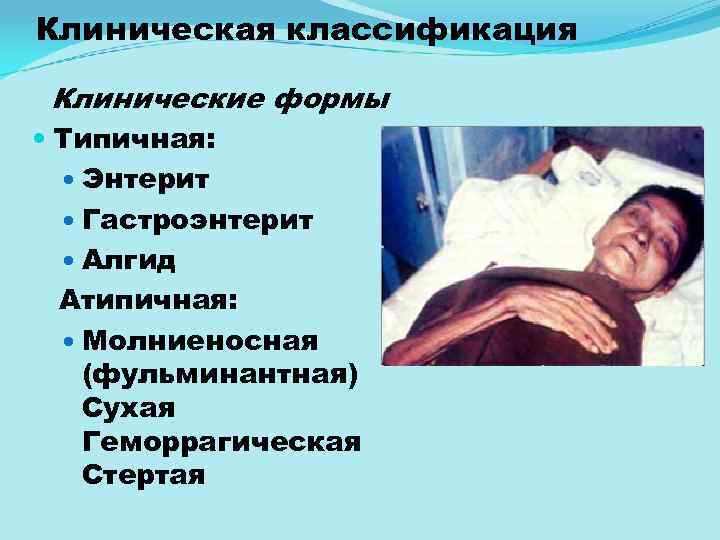 Клиническая классификация Клинические формы Типичная: Энтерит Гастроэнтерит Алгид Атипичная: Молниеносная (фульминантная) Сухая Геморрагическая Стертая