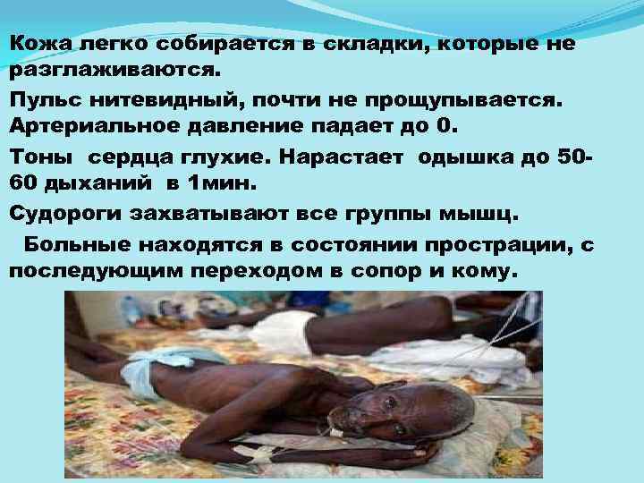 Кожа легко собирается в складки, которые не разглаживаются. Пульс нитевидный, почти не прощупывается. Артериальное