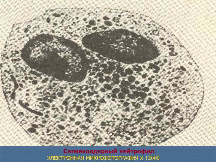 Сегменоядерный нейтрофил ЭЛЕКТРОННАЯ МИКРОФОТОГРАФИЯ X 12000 
