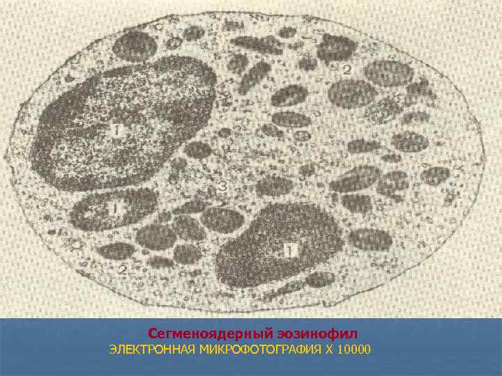 Сегменоядерный эозинофил ЭЛЕКТРОННАЯ МИКРОФОТОГРАФИЯ X 10000 